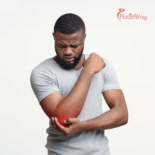 Beyond Surgery Puerto Vallarta’s Regenerative Clinics Help Canadians with Joint Pain